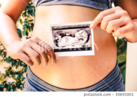Pregnant Woman Holding Ultrasound Scan Photo blur background 30693801