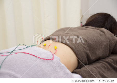 電針 電針 30694036