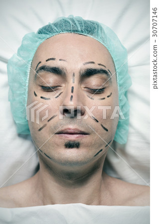 man about to have a plastic surgery 30707146