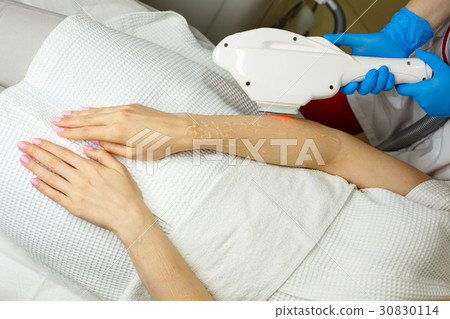 Elos hair removal 30830114