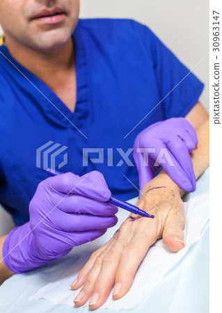 Plastic Surgeon Doctor Marks Hand of Senior Woman 30963147