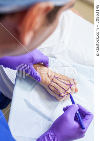 Plastic Surgeon Doctor Marks Hand of Senior Woman Plastic Surgeon Doctor Marks Hand of Senior Woman 30963148