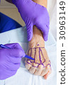 Plastic Surgeon Doctor Marking Hand of Woman 30963149