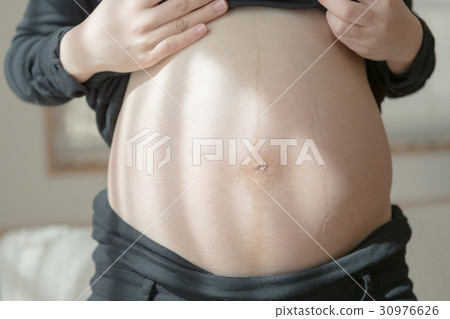 懷孕 孕婦 肚子 30976626