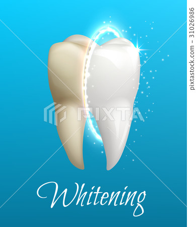 Teeth whitening concept with clean and dirty tooth 31026986