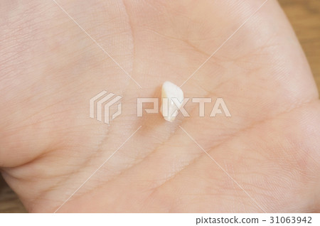 Missing tooth and milk case Missing tooth and milk case 31063942