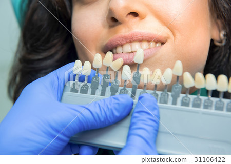 Tooth whitening chart. Tooth whitening chart. 31106422