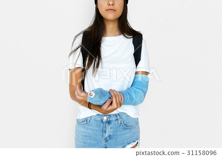 Young Adult Woman with Broken Arm Studio Portrait 31158096