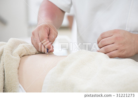 艾灸治療形象 31221273