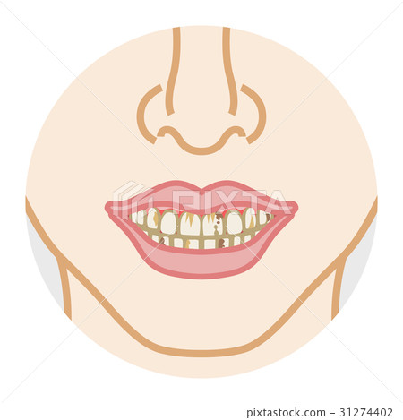 Dental caries pigmented body parts 31274402
