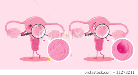 cute cartoon uterus 31278211