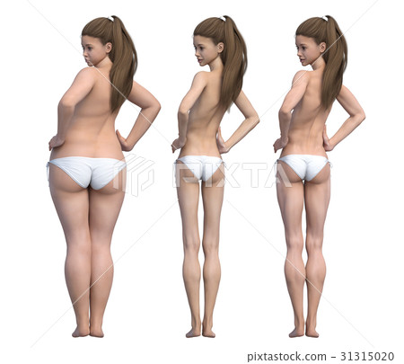 Diet image Before after After perming3dCG illustration material 31315020