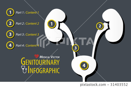 Genitourinary Infographic . Flat design . Genitourinary Infographic . Flat design . 31403552