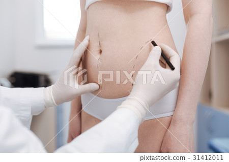 Intent good plastic surgeon consulting his patient 31412011