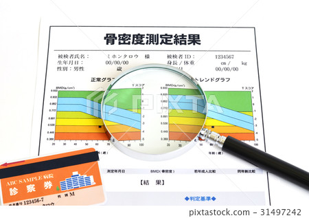 Osteoporosis 31497242