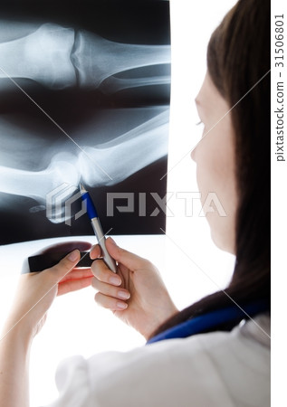 Doctor looking at the x-ray picture knee 31506801