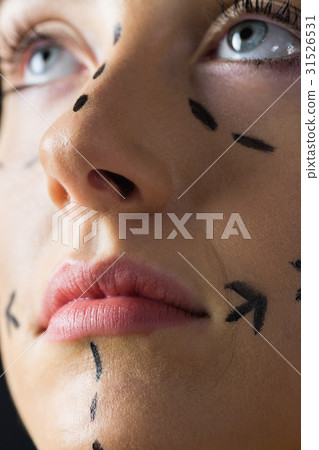 Peaceful young patient with dotted lines on the face Peaceful young patient with dotted lines on the face 31526531