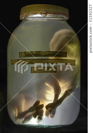 The embryo calf in formaldehyde 31593327