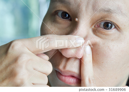 asian woman try to squeeze nose acne pimples asian woman try to squeeze nose acne pimples 31689906