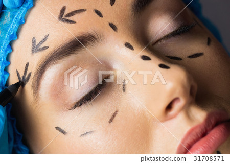 Peaceful young patient with dotted lines on the face 31708571
