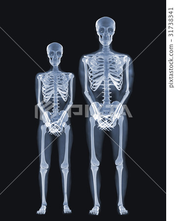 X-ray Concept 31738341