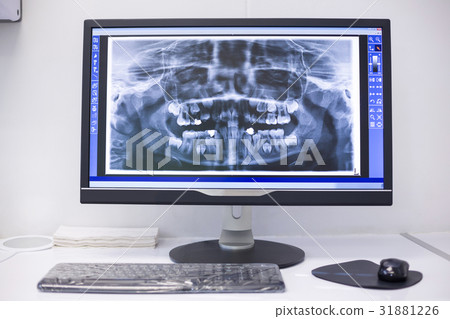 An x-ray on the monitor An x-ray on the monitor 31881226