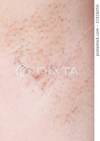 armpit of woman with hair 31916050