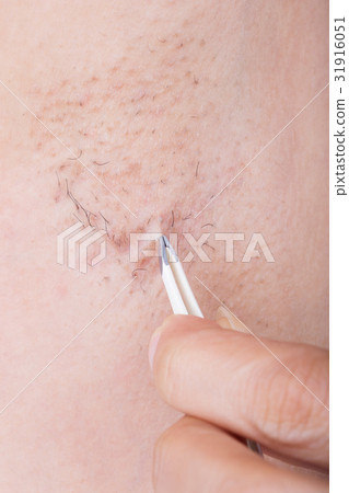 hand of woman plucking hair in her armpit hand of woman plucking hair in her armpit 31916051