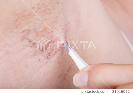 hand of woman plucking hair in her armpit hand of woman plucking hair in her armpit 31916052