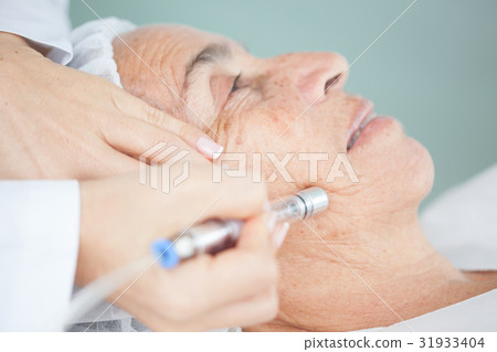 Microdermabrasion treatment on a senior woman face 31933404
