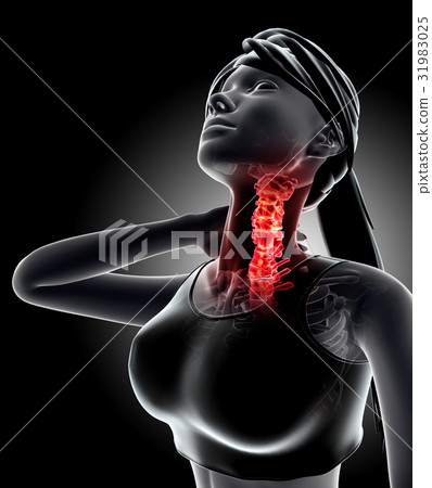 Neck painful cervica spine x-ray, 3D illustration. Neck painful cervica spine x-ray, 3D illustration. 31983025