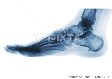 X-ray normal human foot . Lateral view .  32071294