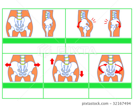 骨盆變形/分類圖3(綠色,無解釋) 骨盆變形/分類圖3(綠色,無解釋) 32167494