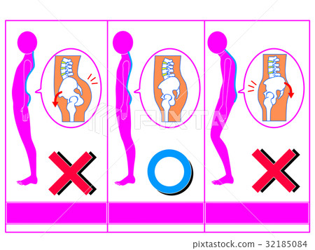 Comparison of distortion of pelvis (anterior tilt / normal / posterior tilt) pink color 2 Comparison of distortion of pelvis (anterior tilt / normal / posterior tilt) pink color 2 32185084