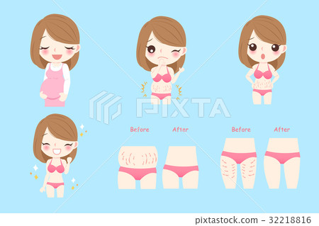 pregnant woman with stretch marks pregnant woman with stretch marks 32218816