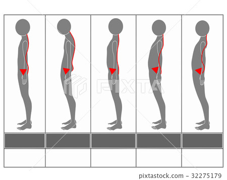 Type of posture (gray · no explanation) 32275179