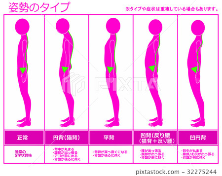 Type of posture (pink color) 32275244