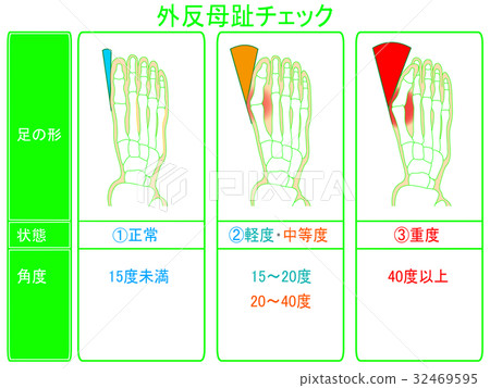 Progress degree check of hallux valgus (green · description included) 32469595