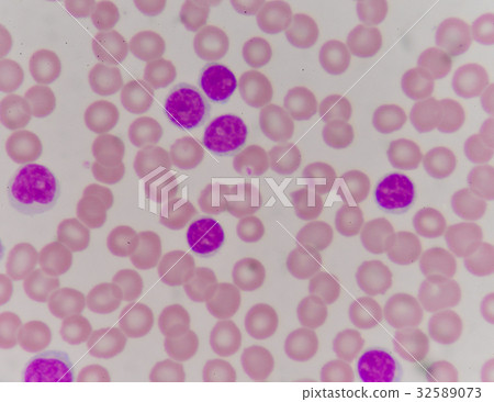 blood smear 32589073