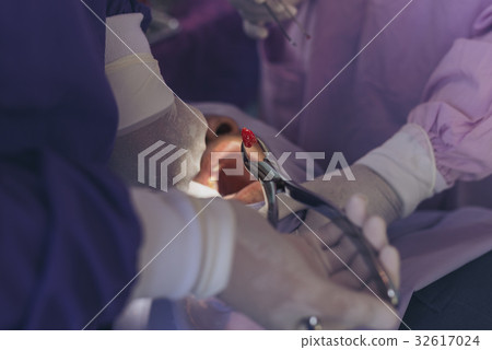 The dentist is removing the decaying tooth  32617024
