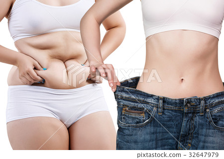 Woman's body before and after weight loss. Woman's body before and after weight loss. 32647979