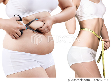 Woman's body before and after weight loss. Woman's body before and after weight loss. 32647985