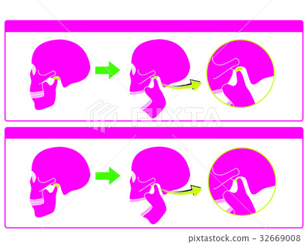 Normal temporomandibular joint and temporomandibular joint disease 5 (pink color and no character) 32669008