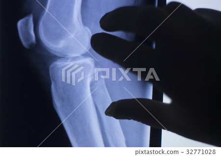Knee joint xray test scan 32771028