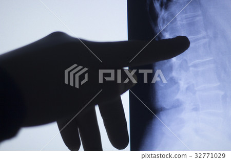 Back spine vertabrae xray scan 32771029