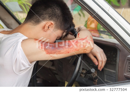patient Injury upper arm in car patient Injury upper arm in car 32777504