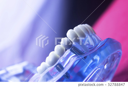 Dentists dental tooth model Dentists dental tooth model 32788847