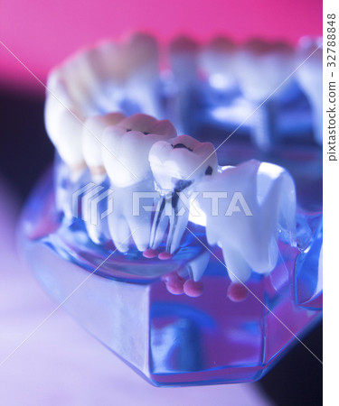 Dental tooth root canal Dental tooth root canal 32788848