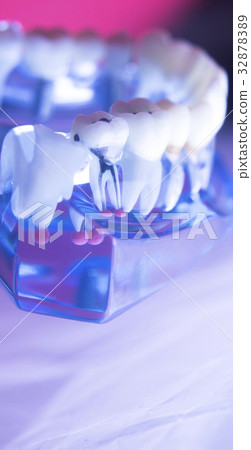 Dental tooth root canal 32878389