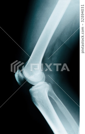 Knee bone anatomy Knee bone anatomy 32894031